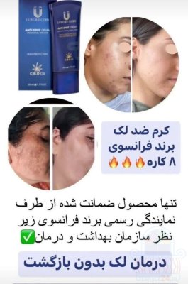 بیوممتیک 8 کاره فرانسوی