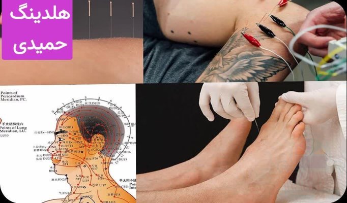 طب سوزنی و ثبت مدرک معتبر